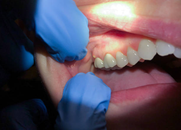 Professional Emergency Dentist in NV